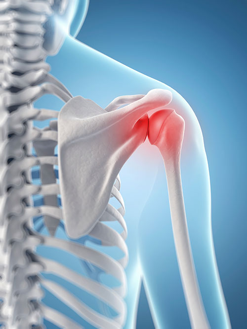 Shoulder Orthopedic Services Sports Injuries