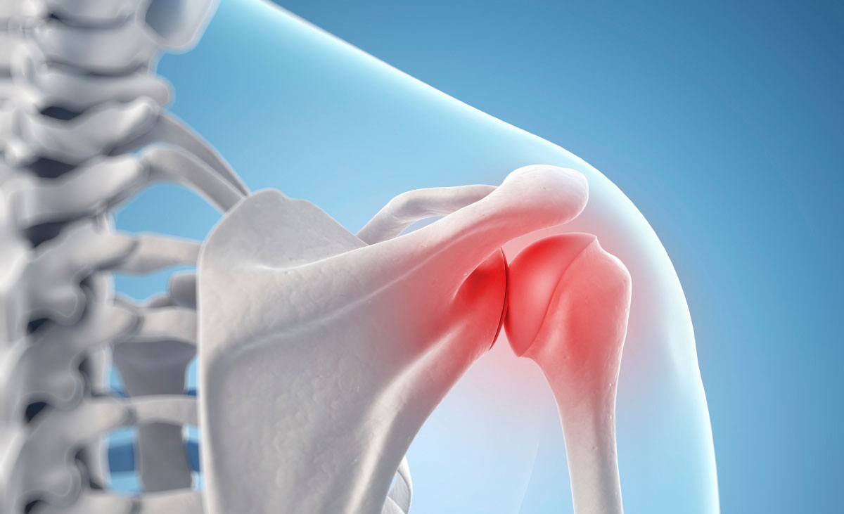 Osteoarthritis & Stem Cell Therapy Fretured Image
