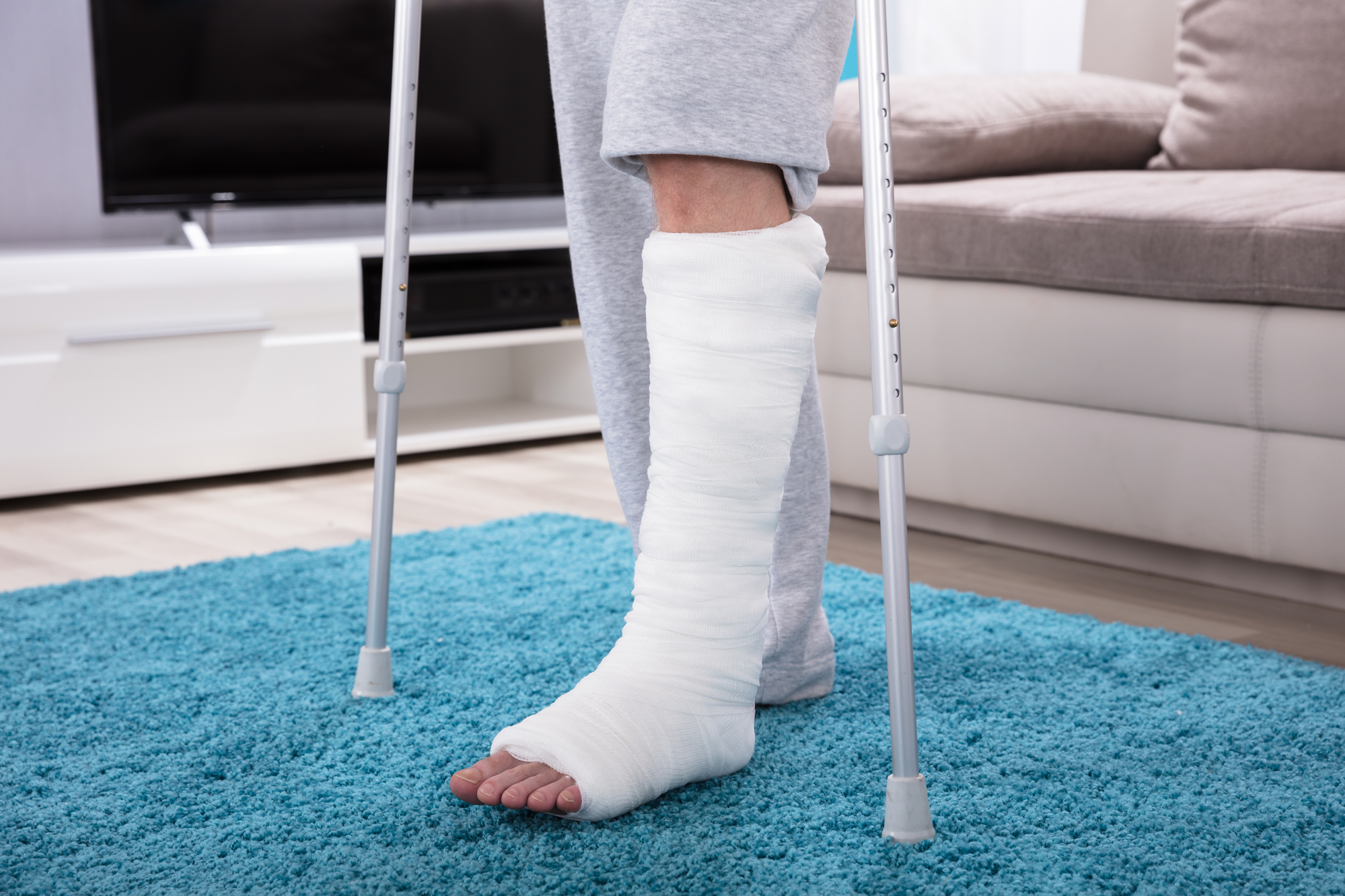 In Office Fracture Care: Avoid The Emergency Room Fretured Image