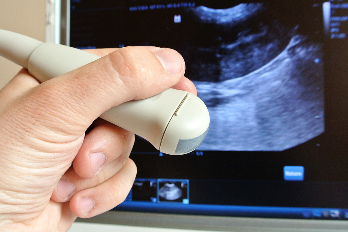 Musculoskeletal Ultrasound: Working for You Fretured Image
