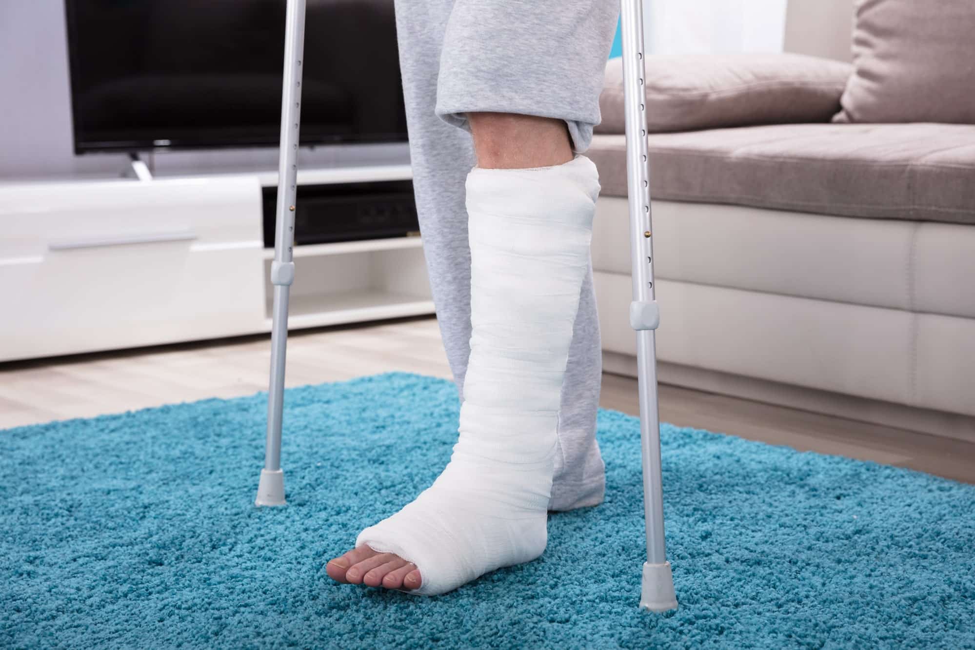 In Office Fracture Care: Avoid The Emergency Room Fretured Image