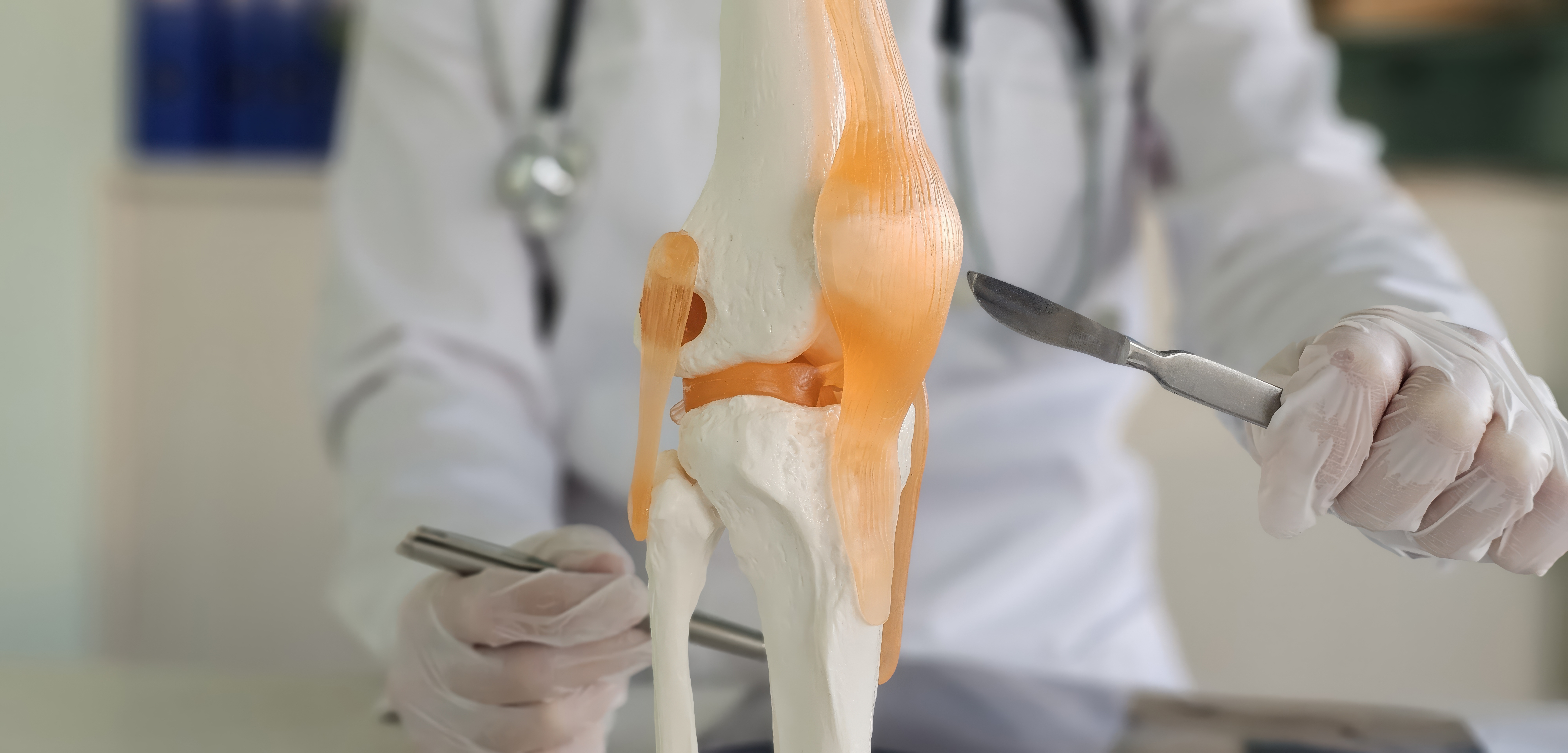 Am I a Candidate for Arthroscopy? Fretured Image